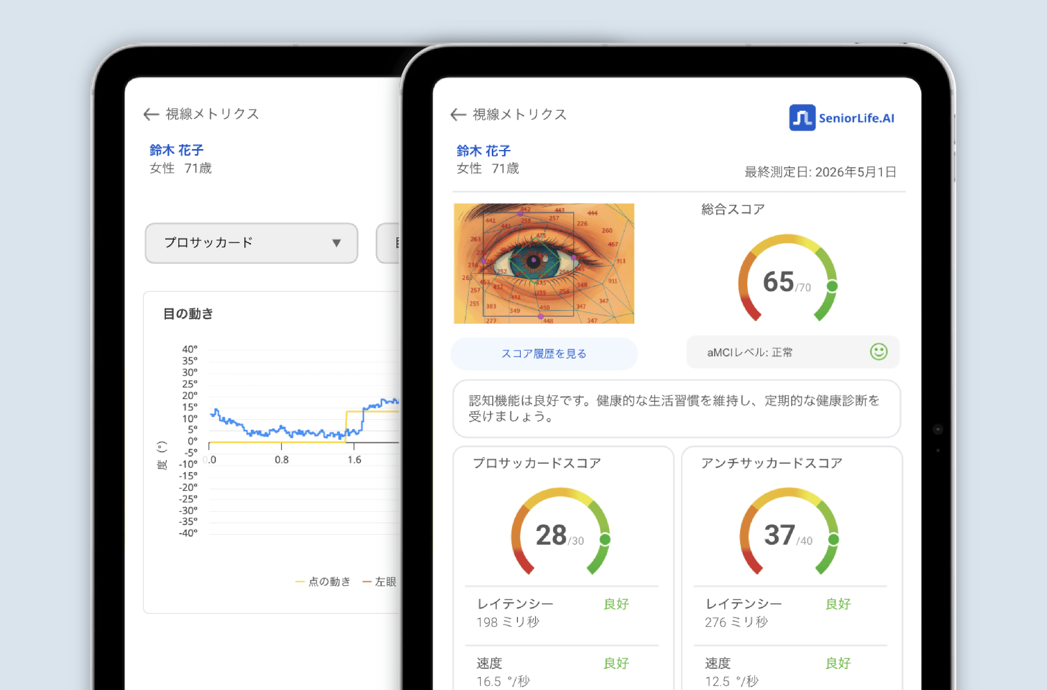 iPadの視線評価結果画面（サッケードスコアと総合スコア）